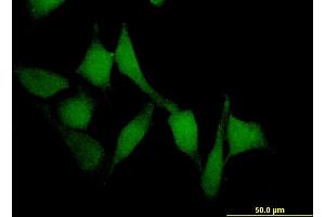 Immunofluorescence of monoclonal antibody to SMAD7 on HeLa cell.