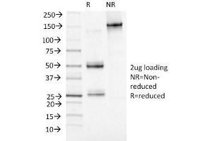SDS-PAGE Analysis Purified Adipophilin Mouse Monoclonal Antibody (ADFP/1493). (ADRP anticorps  (AA 249-376))