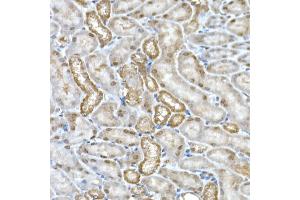 Immunohistochemistry of paraffin-embedded mouse kidney using DC Rabbit mAb (ABIN7266685) at dilution of 1:200 (40x lens). (DCAF7 anticorps)