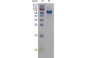 Amphiregulin (AREG) (AA 20-187) protein (Fc Tag)
