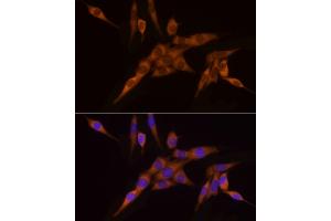Immunofluorescence analysis of PC-12 cells using N Rabbit mAb (ABIN7268773) at dilution of 1:200 (40x lens). (NAT1 anticorps)