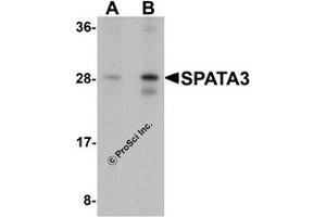 Western Blotting (WB) image for anti-Spermatogenesis Associated 3 (SPATA3) (C-Term) antibody (ABIN1077366) (SPATA3 anticorps  (C-Term))