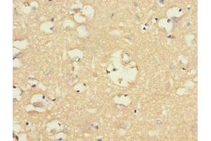 Immunohistochemistry of paraffin-embedded human brain tissue using ABIN7161350 at dilution of 1:100 (CHRNA9 anticorps  (AA 26-240))