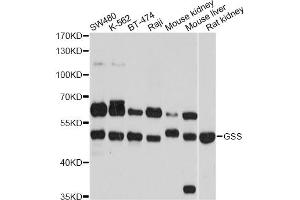 Western blot analysis of extracts of various cell lines, using GSS antibody (ABIN6290429) at 1:1000 dilution.