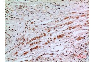 Immunohistochemistry (IHC) analysis of paraffin-embedded Human Brain, antibody was diluted at 1:100. (alpha Tubulin anticorps)