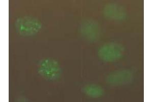 Immunofluorescence (IF) image for anti-Chromatin Assembly Factor 1, Subunit B (p60) (CHAF1B) antibody (ABIN1105633)