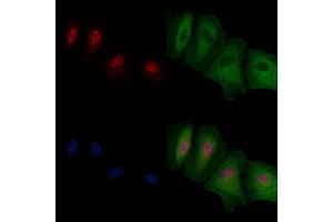 ABIN6263716 and ABIN6276741 staining  cells by IF/ICC.