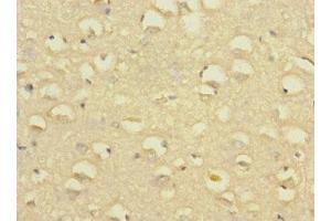 Immunohistochemistry of paraffin-embedded human brain tissue using ABIN7170057 at dilution of 1:100