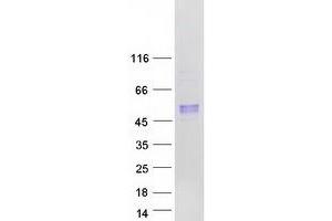 Validation with Western Blot