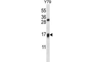 Western Blotting (WB) image for anti-Vitamin K Epoxide Reductase Complex, Subunit 1-Like 1 (VKORC1L1) antibody (ABIN2997461) (VKORC1L1 anticorps)