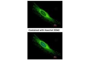 ICC/IF Image Immunofluorescence analysis of methanol-fixed HeLa, using PEX26, antibody at 1:500 dilution.