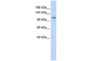 ZMIZ1 antibody used at 0.