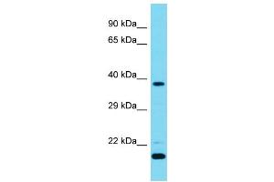 Host: Rabbit  Target Name: Camk1d  Sample Tissue: Mouse Testis lysates  Antibody Dilution: 1. (CAMK1D anticorps  (N-Term))