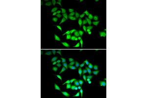 Immunofluorescence analysis of U20S cell using CCT3 antibody. (CCT3 anticorps)
