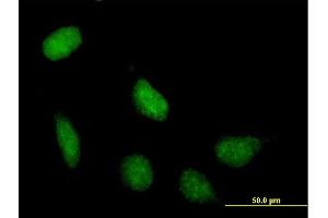 Immunofluorescence of purified MaxPab antibody to SIRT7 on HeLa cell. (SIRT7 anticorps  (AA 1-400))