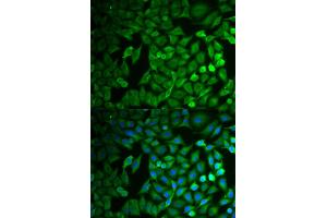Immunofluorescence analysis of MCF-7 cells using FBXO11 antibody (ABIN5973628).