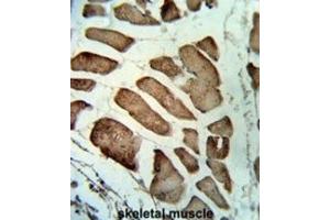 Immunohistochemistry (IHC) image for anti-Leiomodin 1 (LMOD1) antibody (ABIN3003829)