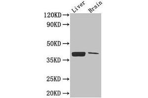Western Blot Positive WB detected in: Mouse liver tissue, Mouse brain tissue All lanes: CXCR4 antibody at 2.