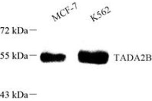 Western blot analysis of TADA2B (ABIN7075957) at dilution of 1: 1000,Lane 1: MCF-7 cell lysate,Lane 2: K562X cell lysate
