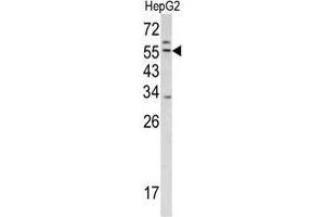 Western blot analysis of TMPRSS2 antibody (Center) in HepG2 cell line lysates (35ug/lane).