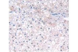 Detection of IFNa5 in Human Liver Tissue using Monoclonal Antibody to Interferon Alpha 5 (IFNa5)