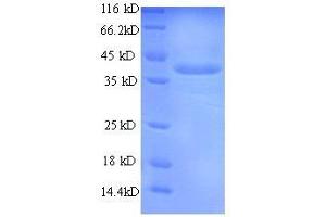 Protein expressed in E. (CMA1 Protein (AA 22-249, full length) (His tag))