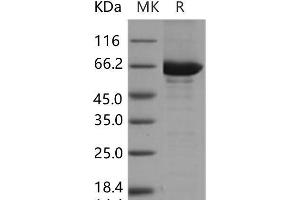 Western Blotting (WB) image for C-Src tyrosine Kinase (CSK) (Active) protein (GST tag,His tag) (ABIN7320001)