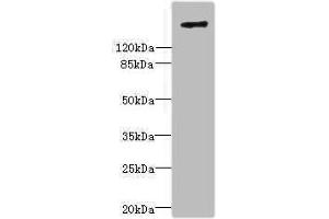 Western blot analysis of Complement C3 antibody (20 μg/ml) with Goat anti-Rabbit polyclonal antibody (1/10000 dilution).