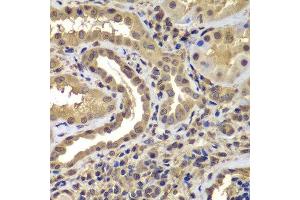 Immunohistochemistry of paraffin-embedded human kidney using PSMB8 antibody.