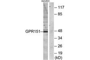 Western blot analysis of extracts from HuvEc cells, using GPR151 Antibody. (GPR151 anticorps  (AA 276-325))