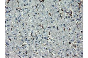 Image no. 6 for anti-GTPase, IMAP Family Member 4 (GIMAP4) antibody (ABIN1498460)
