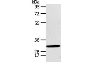 Western blot analysis of Human fetal brian tissue using CALB2 Polyclonal Antibody at dilution of 1:400 (Calretinin anticorps)