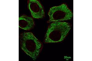 Immunofluorescent analysis of A549 cells, using TBB5 Antibody (ABIN387758 and ABIN2838008).