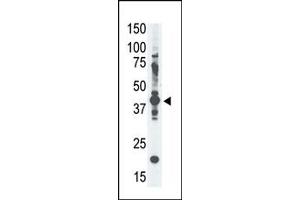 Western Blotting (WB) image for anti-Melanoma Antigen Family A, 4 (MAGEA4) (N-Term) antibody (ABIN358647) (MAGEA4 anticorps  (N-Term))