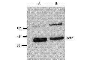Image no. 1 for anti-Perforin 1 (Pore Forming Protein) (PRF1) antibody (ABIN477313) (Perforin 1 anticorps)