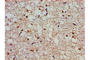 Immunohistochemistry of paraffin-embedded human brain tissue using ABIN7146350 at dilution of 1:100 (SLC25A12 anticorps  (AA 202-317))