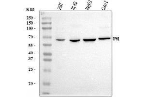 Western blot analysis of Tryptophan Hydroxylase/TPH1 using anti-Tryptophan Hydroxylase/TPH1 antibody (ABIN7601556).