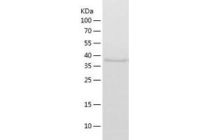 Polymerase (RNA) I Polypeptide C, 30kDa (POLR1C) (AA 1-346) protein (His-IF2DI Tag)