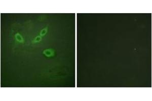Immunofluorescence analysis of HeLa cells, using TUSC5 Antibody. (TUSC5 anticorps  (AA 1-50))