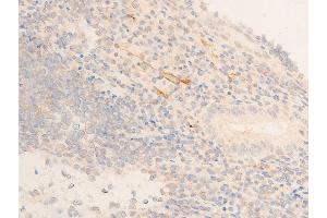 ABIN6267220 at 1/100 staining human appendiceal tissue sections by IHC-P.