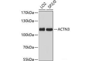 Western blot analysis of extracts of various cell lines using ACTN3 Polyclonal Antibody at dilution of 1:3000. (ACTN3 anticorps)