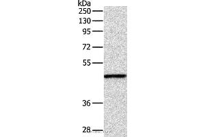 Western blot analysis of Mouse fat tissue, using INHBA Polyclonal Antibody at dilution of 1:1000 (INHBA anticorps)