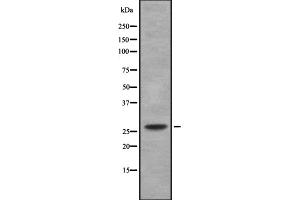 Western blot analysis of C/EBP δ/ε using LOVO whole cell lysates (C/EBP delta/epsilon anticorps)
