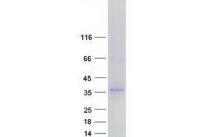 Validation with Western Blot