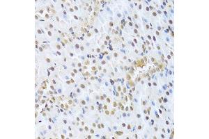 Immunohistochemistry of paraffin-embedded rat kidney using CDK4 Antibody.
