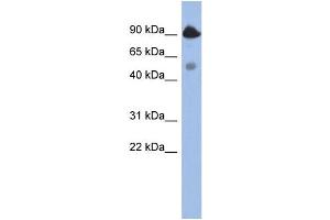 WB Suggested Anti-BCL2L13  Antibody Titration: 0. (BCL2L13 anticorps  (Middle Region))