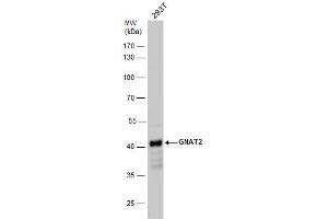WB Image GNAT2 antibody detects GNAT2 protein by western blot analysis. (GNAT2 anticorps  (Center))