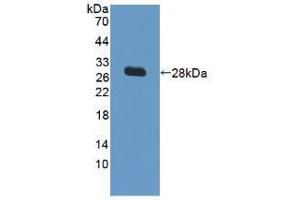Western blot analysis of recombinant Human VCAM1. (VCAM1 anticorps  (AA 109-318))