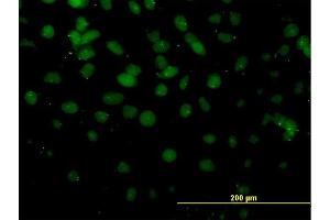 Immunofluorescence of monoclonal antibody to DMTF1 on HeLa cell.