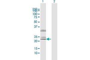 Western Blot analysis of NTF4 expression in transfected 293T cell line by NTF4 MaxPab polyclonal antibody. (Neurotrophin 4 anticorps  (AA 1-210))
